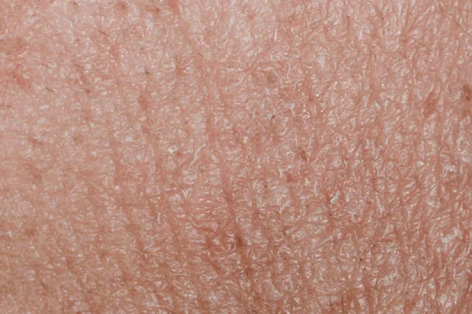 Dehydrated_Skin-min.webp